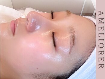 アメリオレ 三鷹店(AMELIORER)の写真/韓国肌管理ララピールの進化版《セラピール》でツヤ肌爆誕！ダウンタイム無しで水光肌へ♪敏感肌の方も◎
