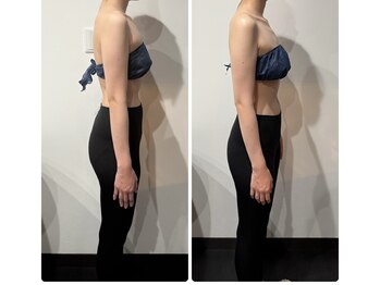 小顔 ツヤ肌/ストレートネック、歪み