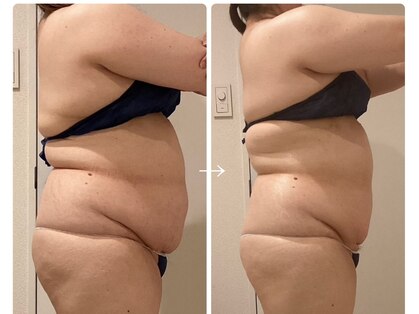 ピュウリリアーナ(Piu liliana)の写真