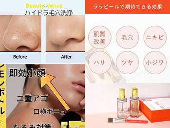 ビューティービーナス(BEAUTY VENUS)の写真/【美肌×小顔☆迷ったらコレ！】ララピール＆レモンボトルで、毛穴・ニキビ・小じわ・脂肪にアプローチ◎