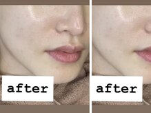 ビジュー(BIJOU)/