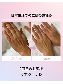 フルールスレーヌ(Fleur Sereine)/ハンドケア