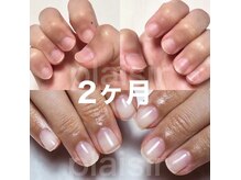 マリーシーオー(MARY-CO.)の雰囲気（自爪育成/2ヶ月経過(ホームケアでオイル2本使用)）