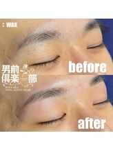男前倶楽部/脱毛/メンズ脱毛/メンズ専門店