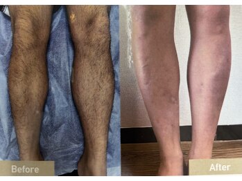 ルシェ(Leche)の写真/清潔感&イメージUP♪自信の持てる肌に導きます*
都度払いなので自分のペースで通いやすい◎