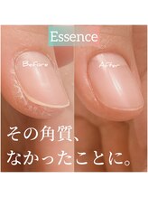 エッセンス (Essence)/トラブル改善ケア