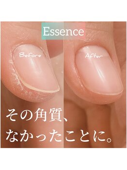 エッセンス (Essence)/トラブル改善ケア