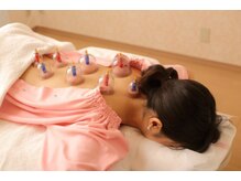 メイロン 恵比寿Mana院(meilong)/大人気カッピング♪美容鍼　小顔