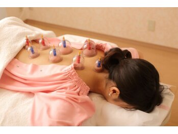 メイロン 恵比寿Mana院(meilong)/大人気カッピング♪美容鍼 小顔