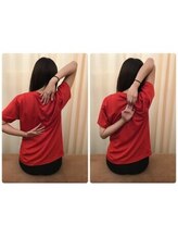 蕨整体院/肩甲骨/肩甲骨はがし/肩こり整体