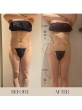 インフィニーズ(INFINEEZ)/カスタム120分ポールシェリー