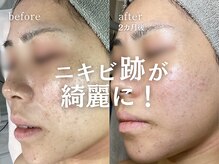 アムリリー 南草津店(AMRILY)の雰囲気（多くの美容家が注目《リアボーテ》正規取扱サロン）