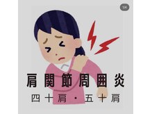 カワル整体 長嶺院/～四十肩・五十肩～