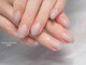 ベリス(Bellis.)の写真/巻き爪、小さな爪、そり爪etc.コンプレックスを忘れさせる指先へ★驚くほど自信を持てる仕上がりに♪