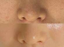 ナチュラル グロウ 木更津(NATURAL GLOW)/セラピール