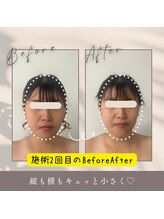 リル(LIL)