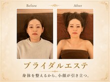 トータルボディケア サニー(TOTAL BODY CARE)の雰囲気（姿勢矯正と痩身エステに小顔矯正を追加のブライダルフルコース）
