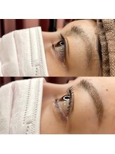 レジアント(Rediant)/パリジェンヌラッシュリフト