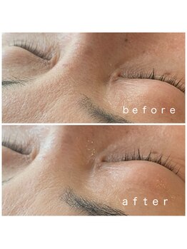 メナードフェイシャルサロン 岐阜茜部/うるおいup/毛穴引き締め