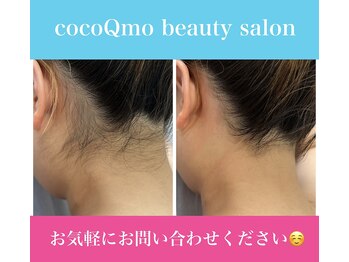 ココキューモオオズ(cocoQmo ozu)/ビフォーアフター