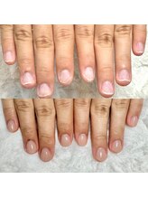 グレースレディ 大阪店/(深爪/長さだし/フィルイン/)