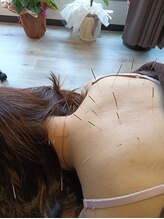 鍼灸整骨院わか/お客様に合わせた施術