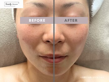 ビューティー ブロッサム(Beauty Blossom)/