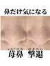 【苺鼻解消したい】もう悩まない!角栓除去で毛穴の根本改善◎