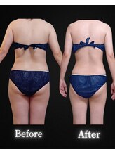 サンティエ(Santie)/別人の姿へ◎