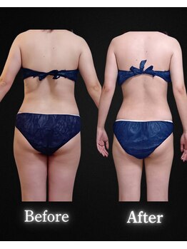 サンティエ(Santie)/別人の姿へ◎