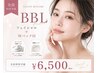 全員ご利用可能!BBL美肌フェイシャル+Wパック