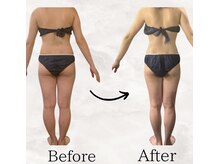 レナータ バイ アフロスクィーン(Renata by Aphros Queen)/Before&After