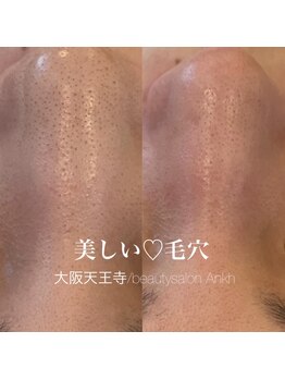 アンク(Ankh)/小さな毛穴も美しく