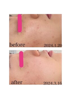 シャングリ ラ(Shangri La)/【白玉ホワイトスノーピール】