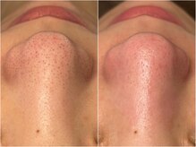 サージュクロレ 松戸店(sage colorer)の雰囲気（フェイシャルメニュー充実！[毛穴・ニキビケア/ピーリング/美肌]）