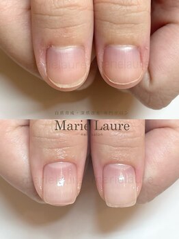 マリーロール 梅田店(Marie Laure)/深爪改善/自爪育成/ネイルケア