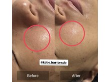 ハリシェンド/ハイドラ×WiQO