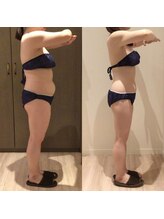 アユアランリンク 札幌店/30代/ブライダル/約7ヵ月/側面