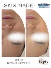 レピア(Le'pia)/トロイアルケ｜スキンメイド