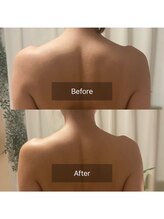 アンフェム(Anfem)/オイルリンパビフォアフ3