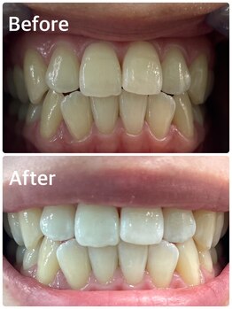 プラチナムビューティー 横須賀店/ビフォーアフター