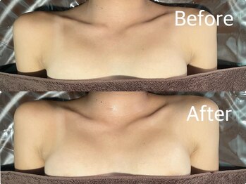 アム(Am.)/バストケア/バストアップ