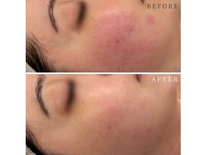 シーベル 新宿の写真