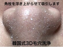 メディカルエステ ユウ(Yuu)の雰囲気（SNSで話題の特許韓国美容！１度でスッキリ！浮き出る毛穴汚れ！）