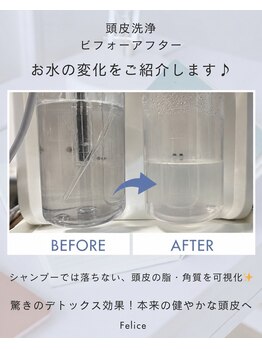 フェリーチェ 大塚店(Felice)/頭皮洗浄で汚れを可視化♪
