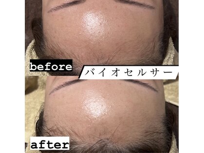 ピウ(PiU)の写真