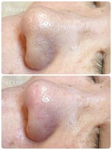 ウィズリーフ(with leaf)/諦めなくてよかった☆