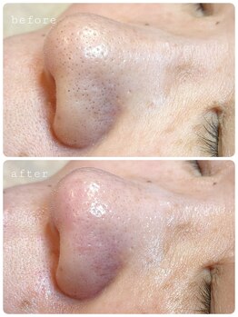 ウィズリーフ(with leaf)/諦めなくてよかった☆