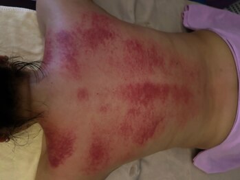 気楽 アロマリンパオイル もみほぐし 栄店/ビーズマッサージスティック