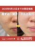 【オプション】9月15日迄/結果に驚き！光フェイシャル4,200円でお試し可能！